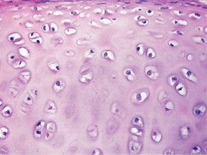 Hyaline cartilage medcell.med.yale.edu