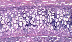 elastic_cartilage_2-www.lookfordiagnosis.com