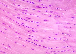 fibrocartilage www.anatomybox.com